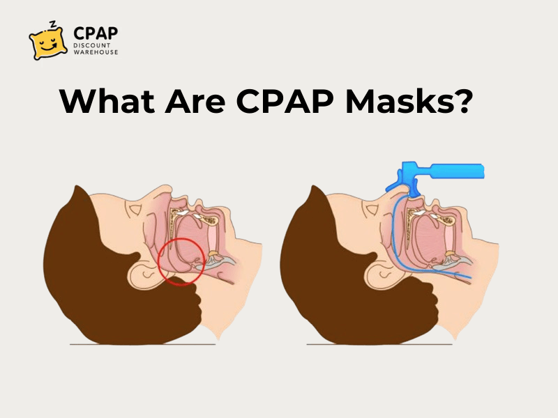 different types of CPAP masks