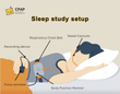 Sleep Study Cost